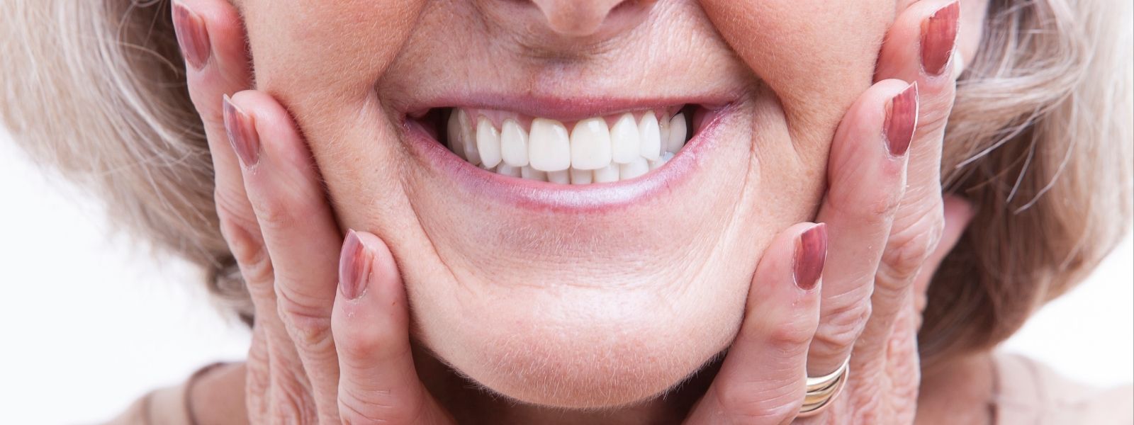 A lady smiling wearing partial Dentures